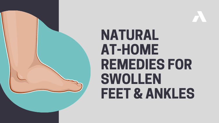 Natural At-Home Remedies for Swollen Feet and Ankles