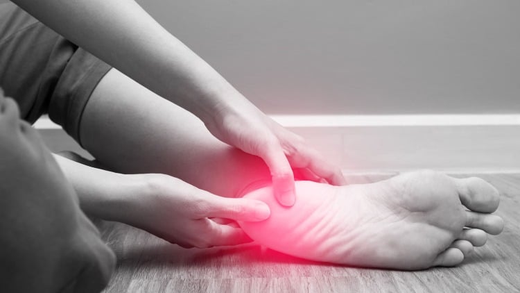 Plantar Fasciitis