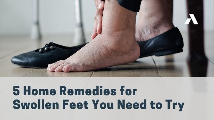 5 Home Remedies for Swollen Feet You Need To Try