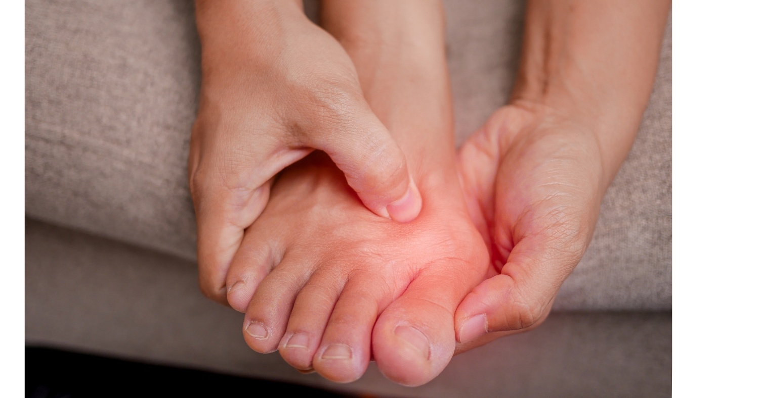 Finding Comfort with Bunions: Options for Bunion Relief