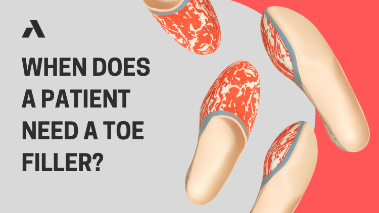When Does a Patient Need a Toe Filler?