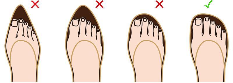 best flats for bunions