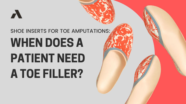 Shoe Inserts for Toe Amputations: When Does a Patient Need a Toe Filler?