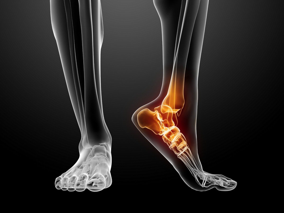 3 Exercises for Reducing Heel Pain