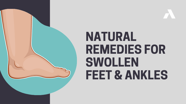 Natural Remedies for Swollen Feet and Ankles